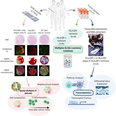 A Multi-Omics Analysis of Metastatic Melanoma Identifies a Germinal Center-Like Tumor Microenvironment in HLA-DR-Positive Tumor Areas